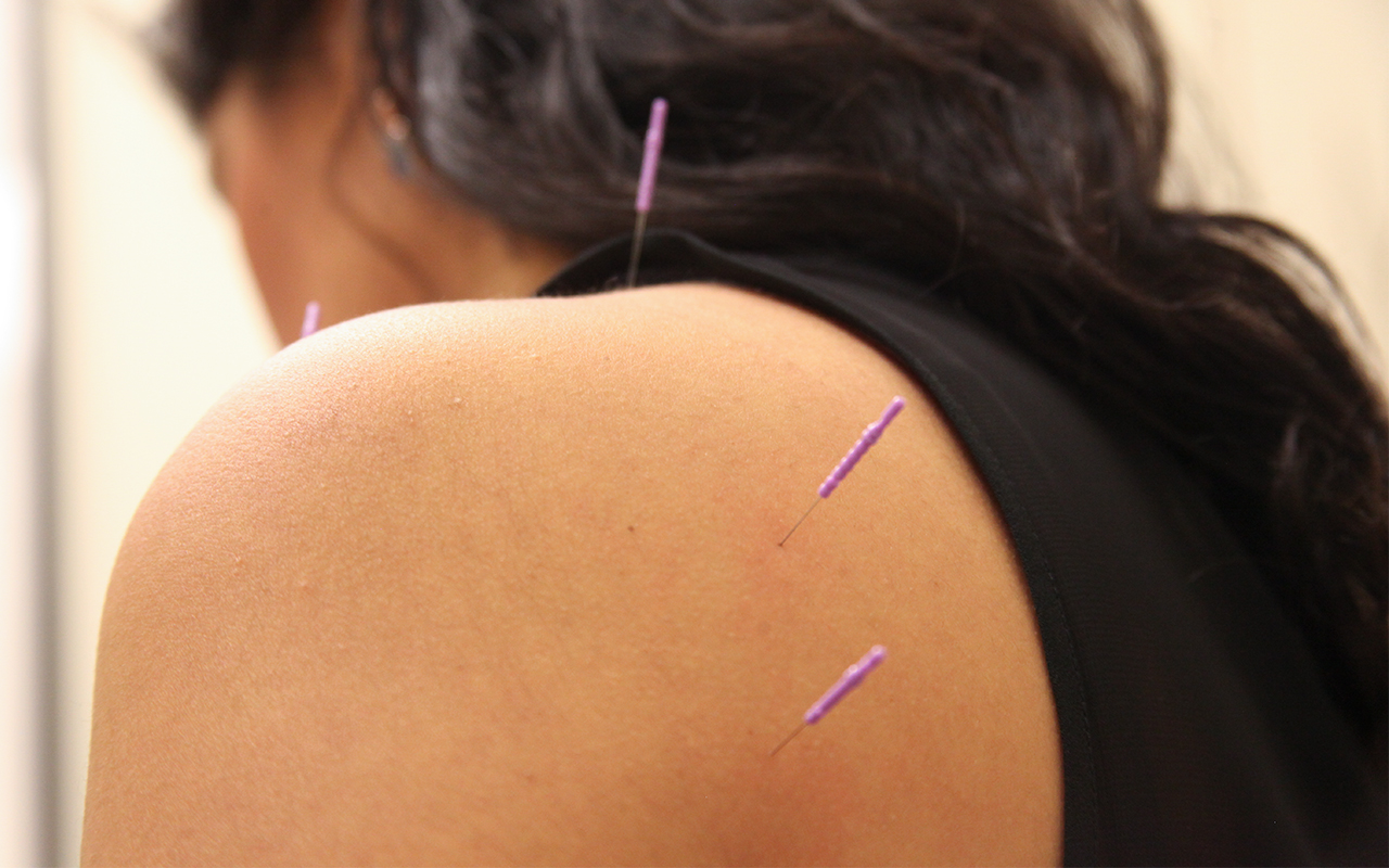 acupuncturist