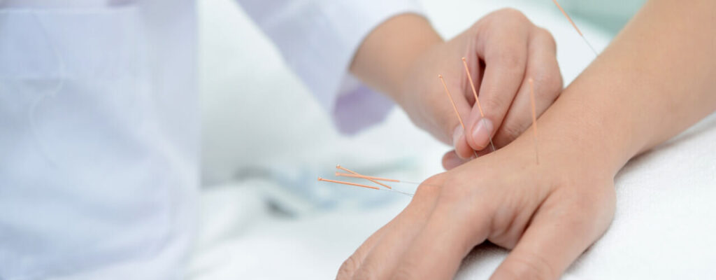 Acupuncture Acupuncturist