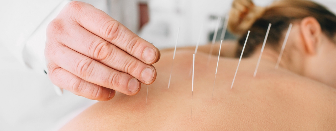 acupuncture-physiochirowellness-ajax-newmarket-vaughan-on
