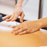 Dry needling Physiotherapy vaughan Newmarket