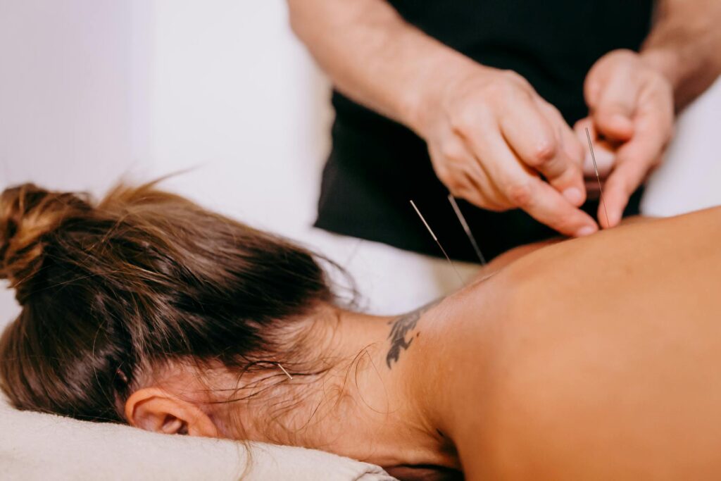 Understanding Acupuncture Vaughan