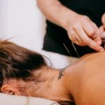 acupuncturist in Vaughan treating a patient with acupuncture points for weight loss support