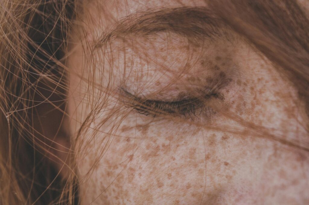 Naturopath in Newmarket consulting a patient with eczema about natural skin treatment options