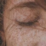 Naturopath in Newmarket consulting a patient with eczema about natural skin treatment options