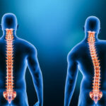 Chiropractor in Vaughan performing specialized scoliosis assessment on patient showing spinal curvature