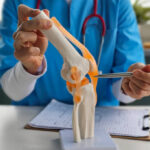 Physiotherapist in Newmarket assisting ACL recovery exercises with patient