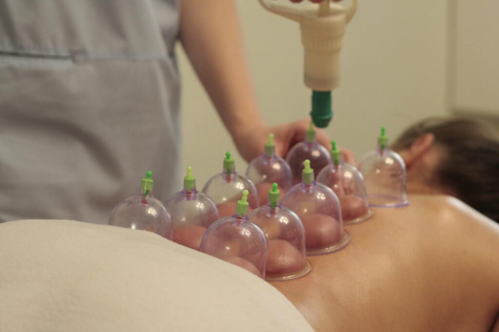 A friendly Newmarket physiotherapist applies cupping therapy to a smiling patient’s back at PhysioChiroWellness.