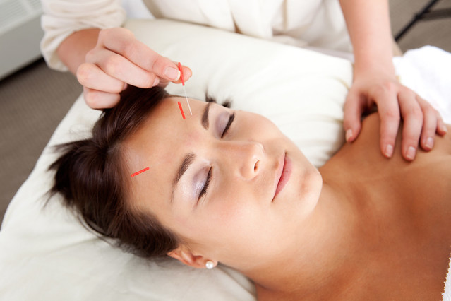 A licensed practitioner performing acupuncture in Newmarket for pain relief